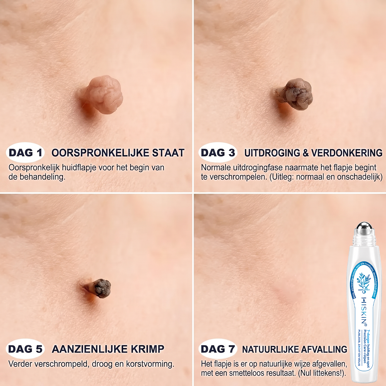 𝐇𝐈𝐒𝐊𝐈𝐍®🎁 Nog maar 5 dozen op voorraad! We geven je nu extra 30% korting! Werk aan je gezondheid en vorm. Mis je deze kans, dan moet je wachten tot volgend jaar!