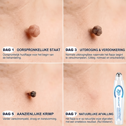 𝐇𝐈𝐒𝐊𝐈𝐍®🎁 Nog maar 5 dozen op voorraad! We geven je nu extra 30% korting! Werk aan je gezondheid en vorm. Mis je deze kans, dan moet je wachten tot volgend jaar!