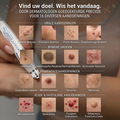 荷) 𝐇𝐈𝐒𝐊𝐈𝐍®👩‍⚕️ 7-daagse huidtag & littekenverwijderaar Pijnloze & littekenvrije geavanceerde rollerballpen voor het verwijderen van onvolkomenheden