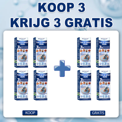荷) 𝐇𝐈𝐒𝐊𝐈𝐍®👩‍⚕️ 7-daagse huidtag & littekenverwijderaar Pijnloze & littekenvrije geavanceerde rollerballpen voor het verwijderen van onvolkomenheden