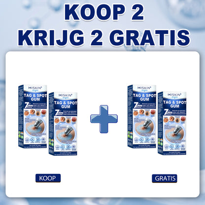 荷) 𝐇𝐈𝐒𝐊𝐈𝐍®👩‍⚕️ 7-daagse huidtag & littekenverwijderaar Pijnloze & littekenvrije geavanceerde rollerballpen voor het verwijderen van onvolkomenheden